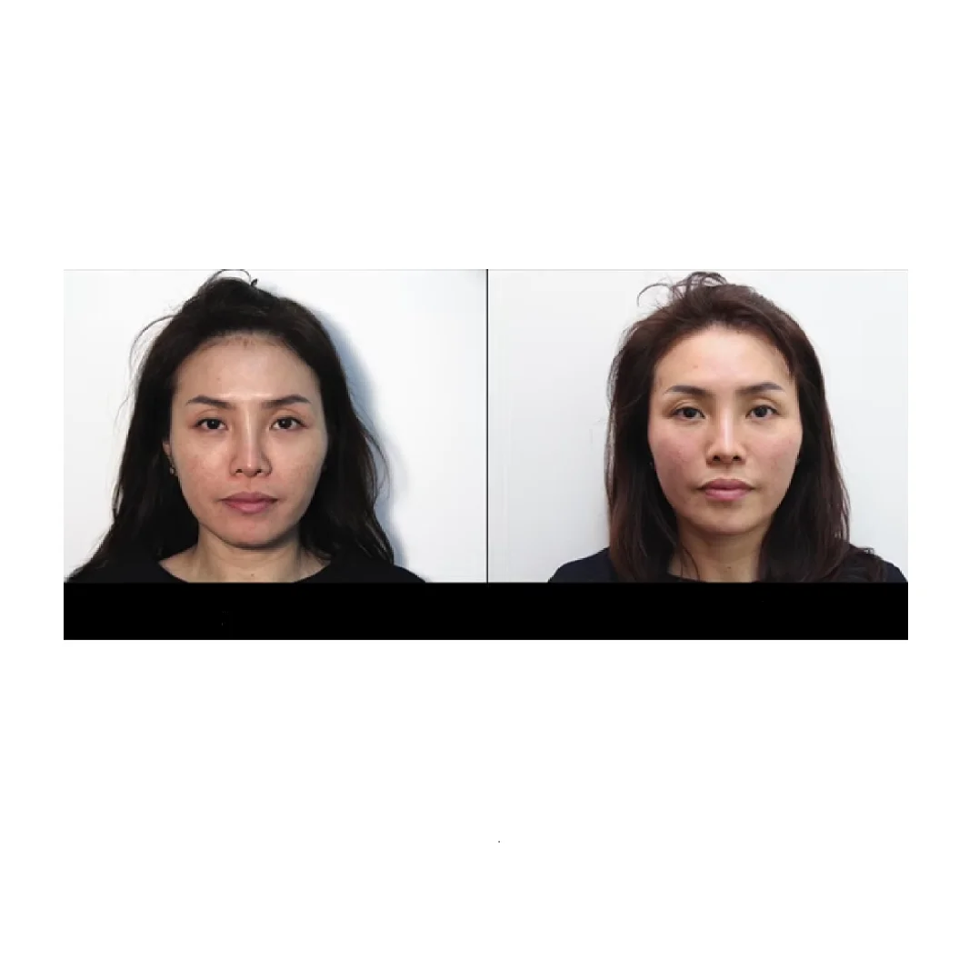 Roller Backdrop Ceiling Wall Mount Stand Image Background Support System For Photography Studio Light Shooting