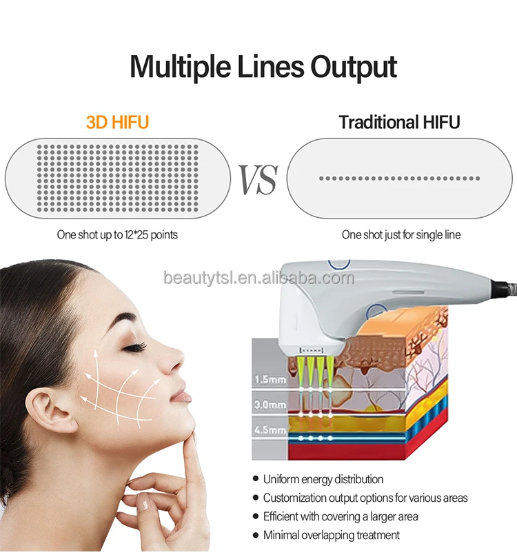 FU4.5-9SC ultramatrix 20