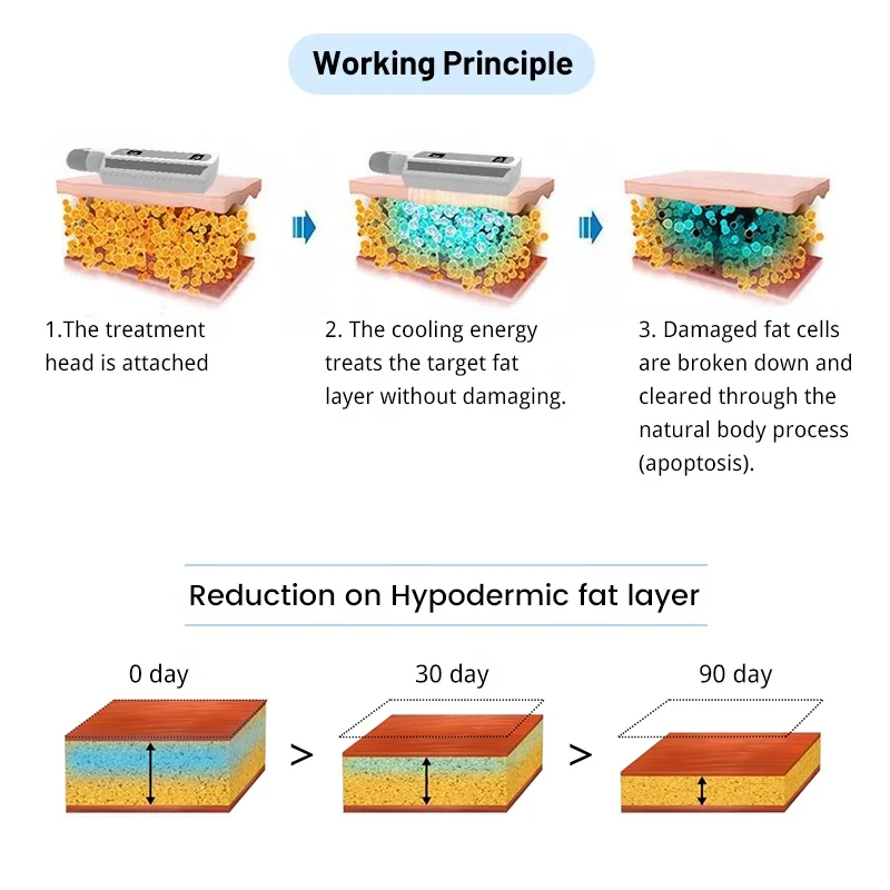 8 Handle Freezing Cold Body Sculpting Device Cryo Slimming Cryolipolyse Cellulite Removal Skin Rejuvenation Ice Sculptures Price