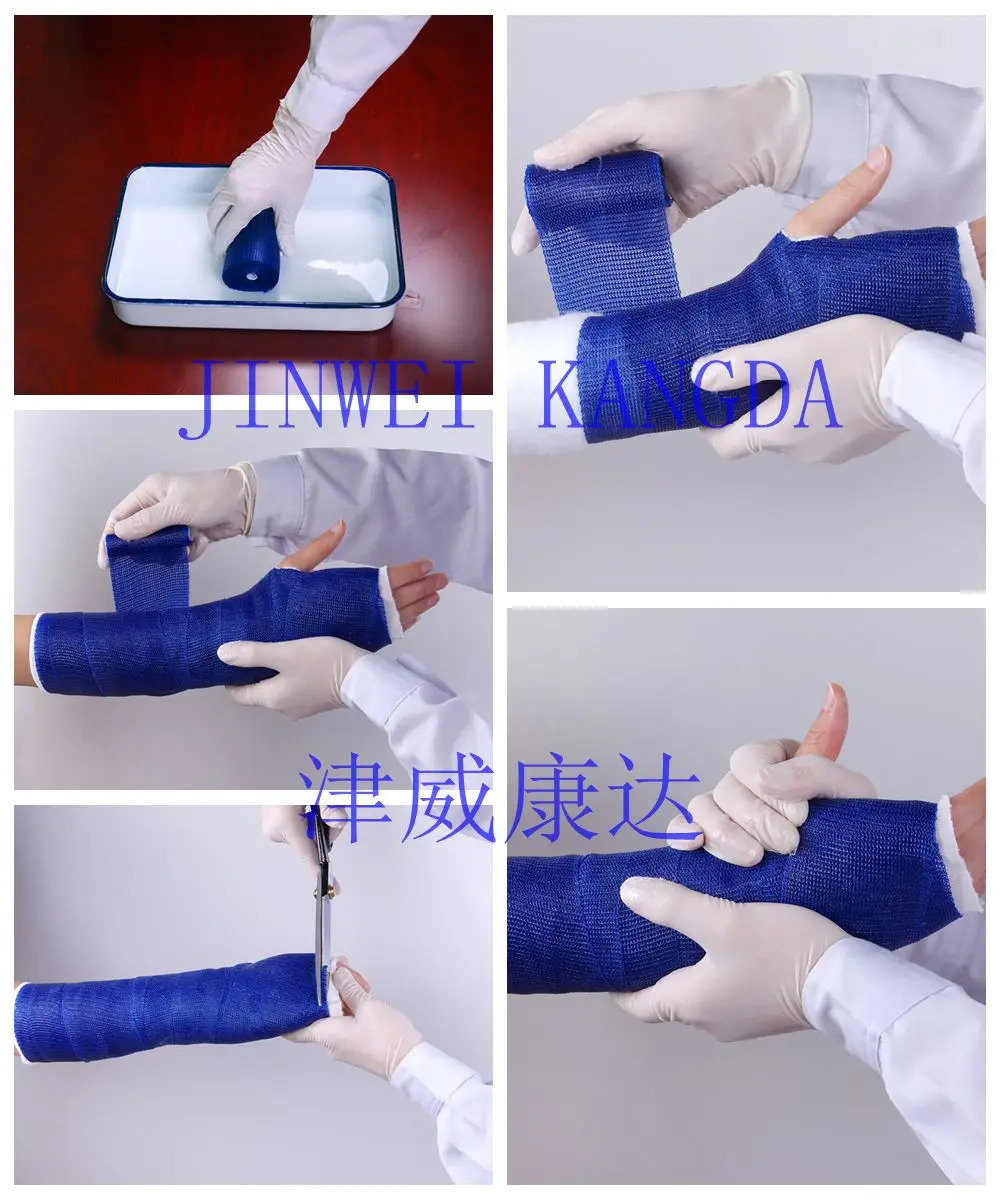 Free Sample Surgical Hospital Consumables Comfortable Fracture Immobilization Fiberglass Cast Bandage