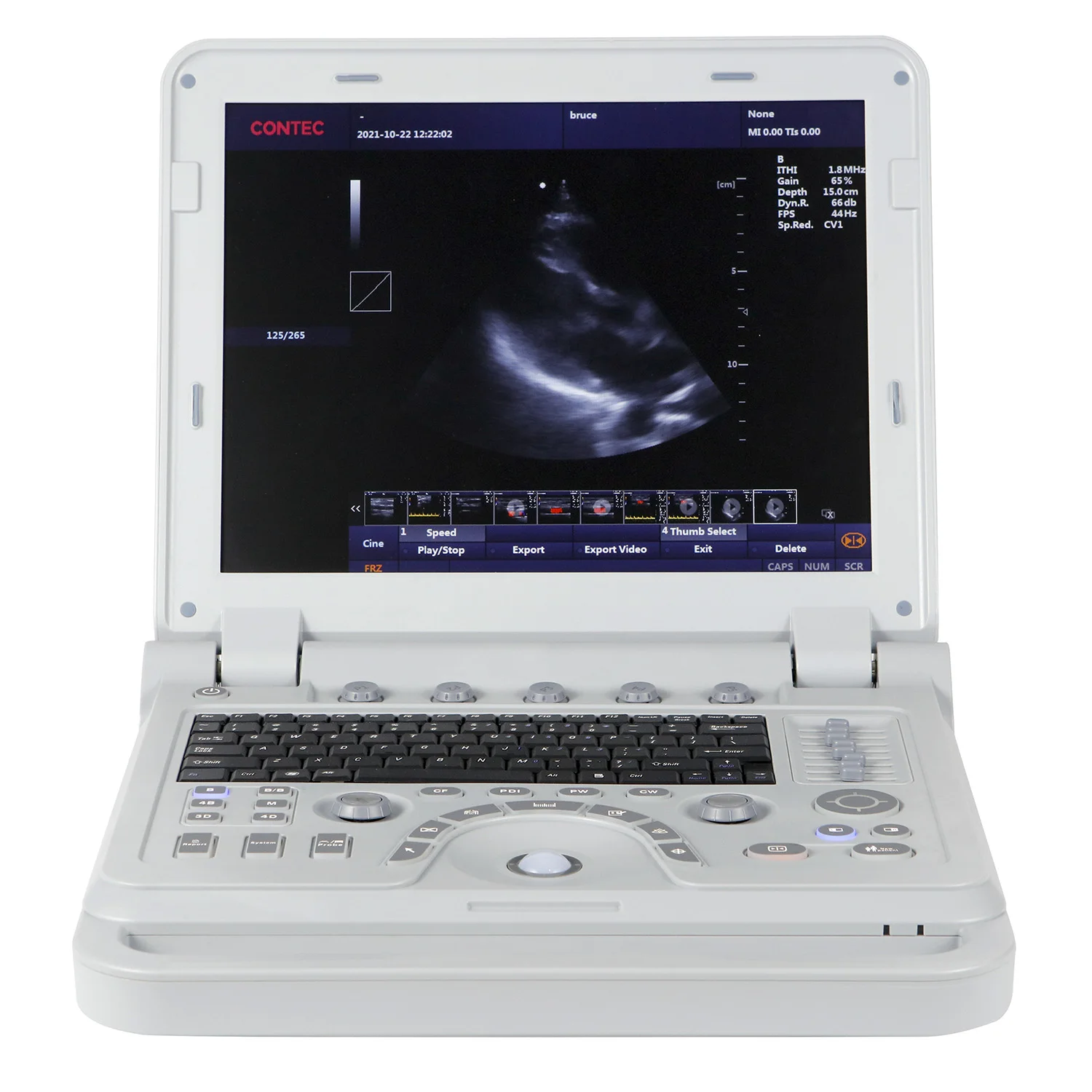 CONTEC CMS1700A colour doppler ultrasound scanner 3in 1 wifi  portable ultrasound table