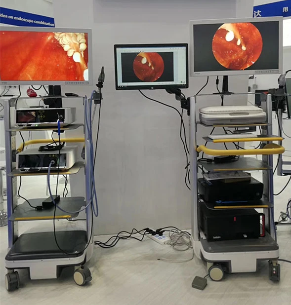 Portable 22 Inch Full Hd 1080p Endoscopic Camera With Recording Function