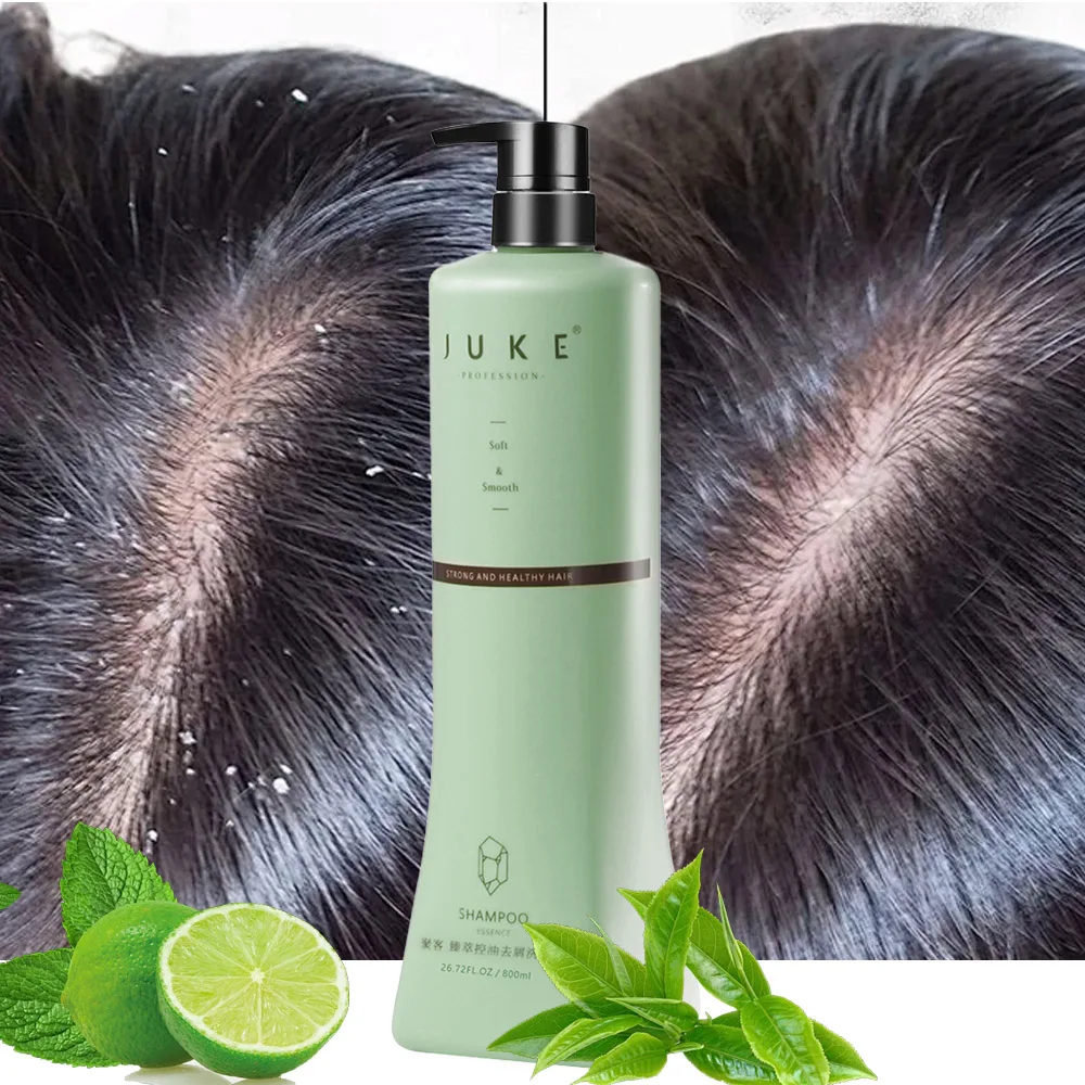 Private Label Plant Extract Herbal Anti Dandruff Hair Scalp Treatment Shampoo and Conditioner for Momen and Men