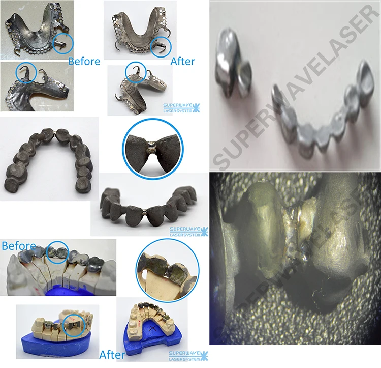 200W Jewelry Welding Machine Spot Welding Machine Dental Welding Machine