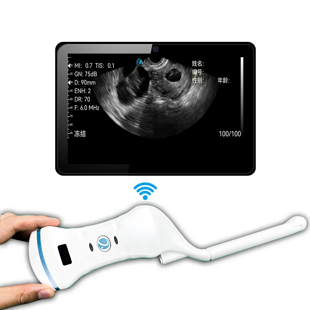 convex and micro convex wireless handheld ultrasound portable for vaginal gyn devices ultrasound portable with low price