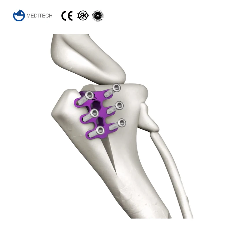 Good Quality Veterinary Orthopedic Implant for Orthopedic Veterinary Tta