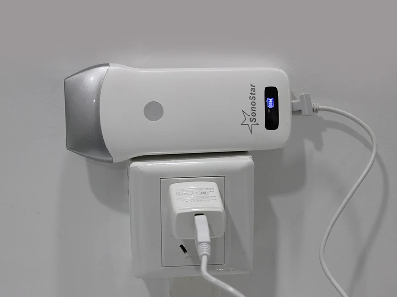 Portable Smart Phone Or Tablet Screen  Wireless Mini Ultrasound Scanner Small Size