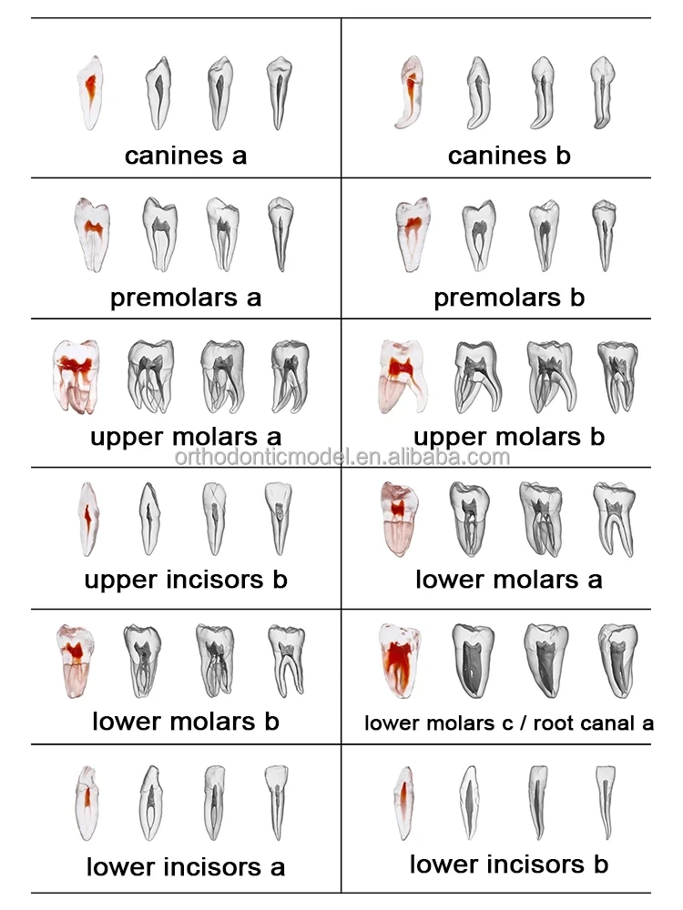 3D Dental Root  Teeth Model Orthodontic Endodontic Teeth Dental Endodontic Rotary Files Typodont Teeth Dentistry Materials