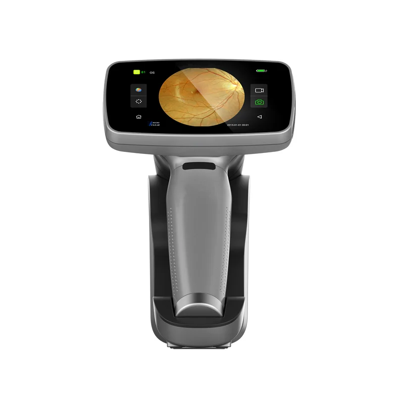 Hand-held Fundus Camera Digital Wifi Ophthalmoscope For Eye Fundus Inspection With 3.97 Inch Touch Screen