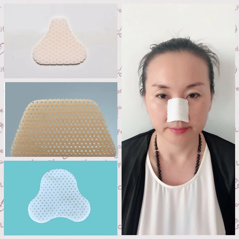 Medical Therapy Equipment External Nasal Splint Sheet Low Temperature Thermoplastic Material
