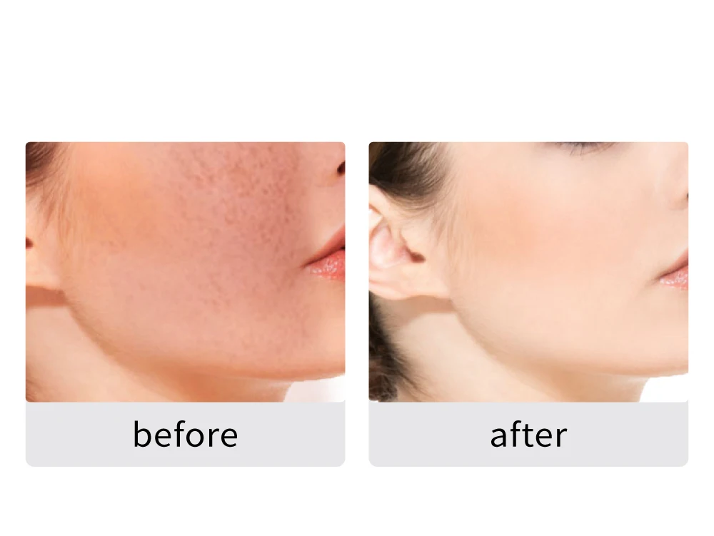 Private Label Skin Care Serum 23% Hyaluronic Acid & VC OEM Organic Anti Aging Brightening Wrinkle Face Vitamin C Serum