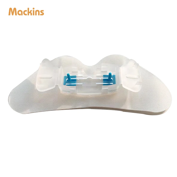 Заводская цена устройство для стабилизации катетера