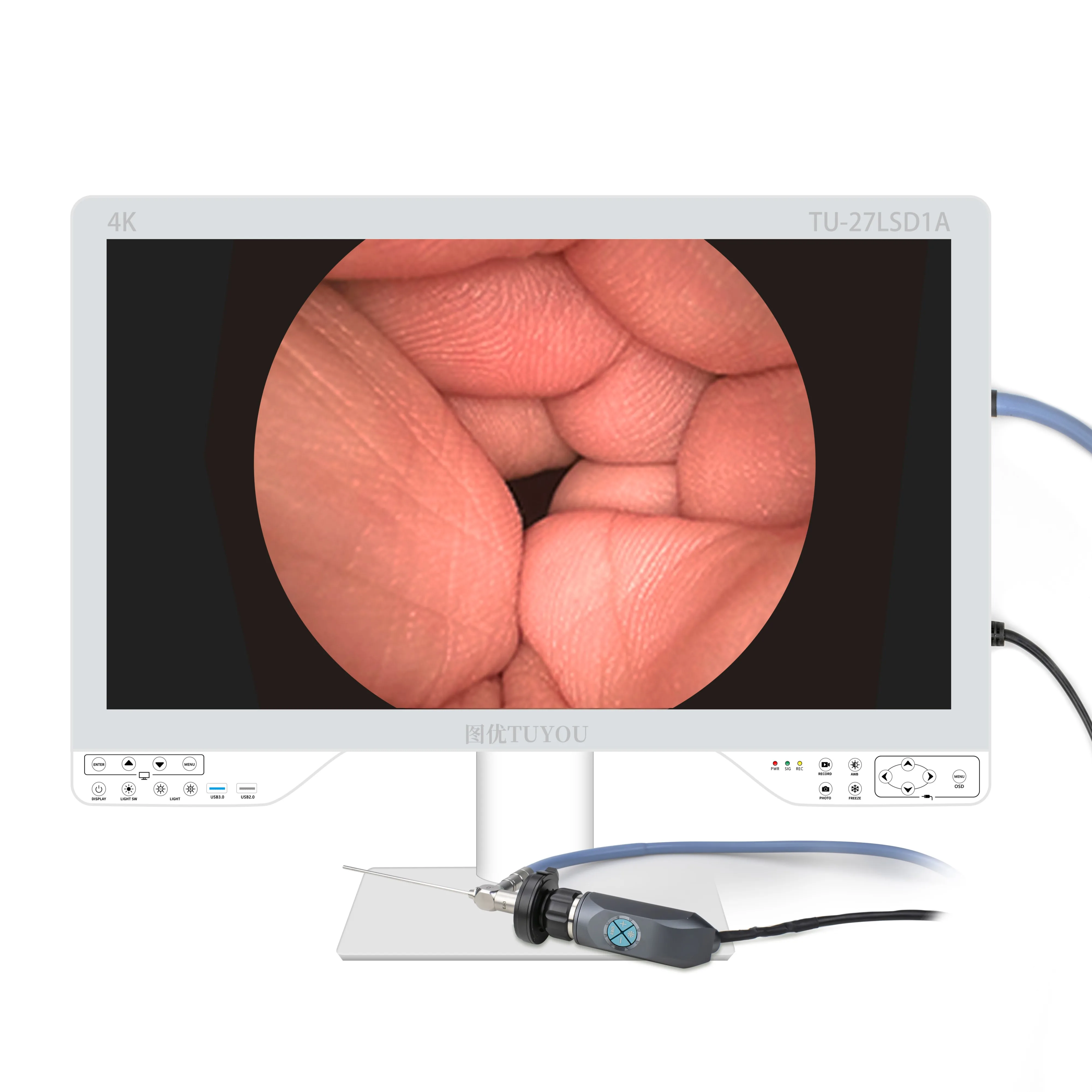 New Arrival 4 IN 1 4K USB video record function Endoscope Camera System with 80W Light Source Medical Grade Monitor