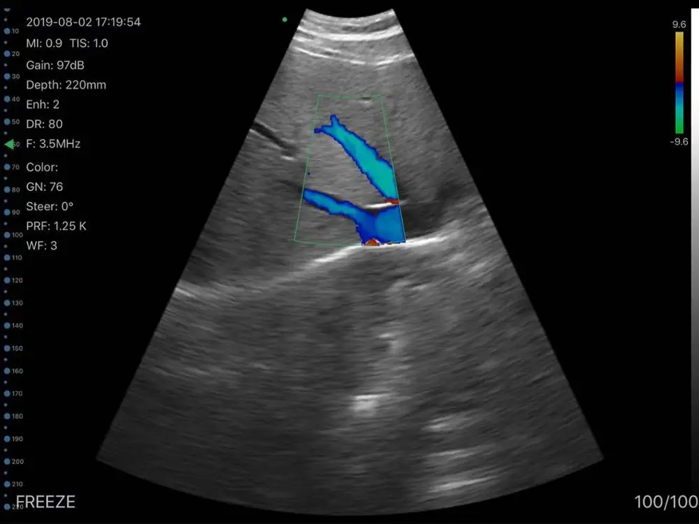Triple Ultrasound Probe Better Than Sonostar Ultrasound Probe