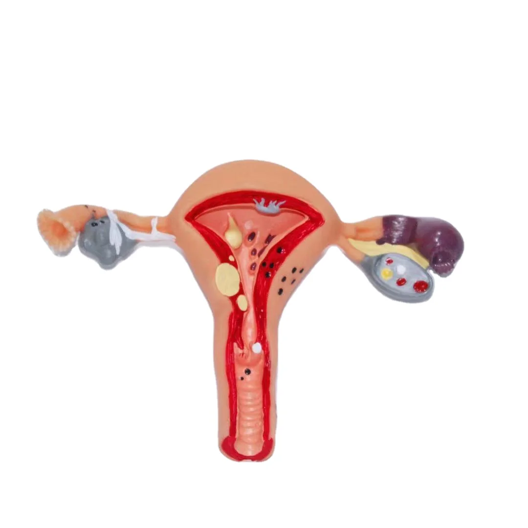 Factory wholesale female pathological 3d pvc uterus ovary anatomical model