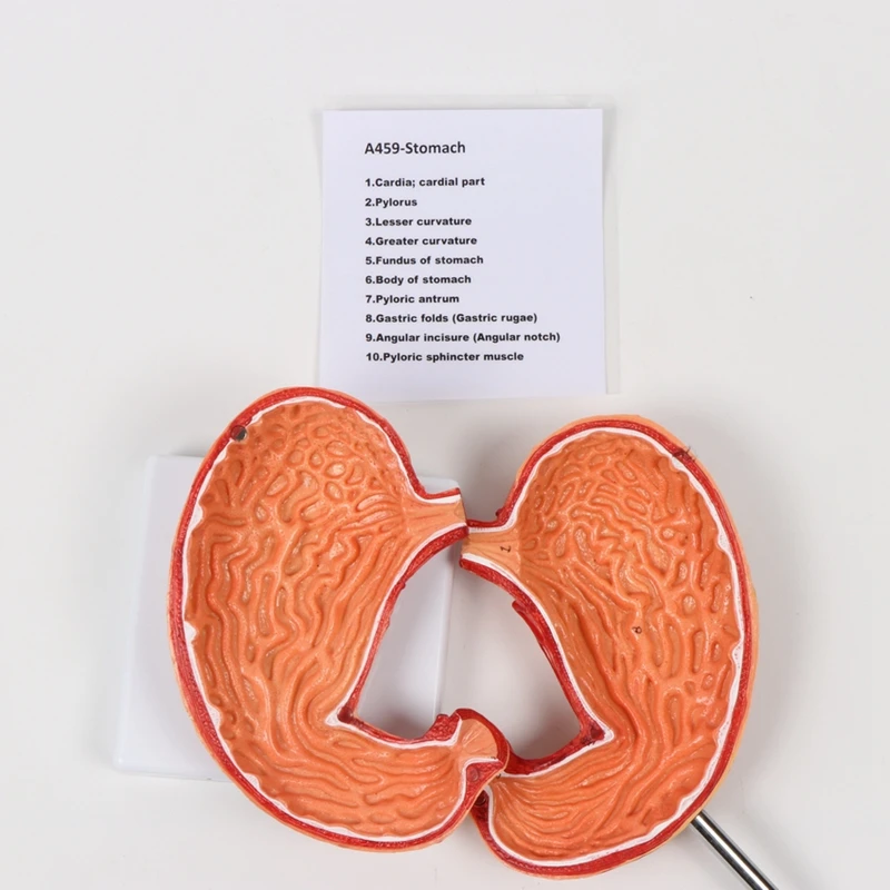 Medical Science Human Digestive System Pathological Stomach Anatomy Model For Education
