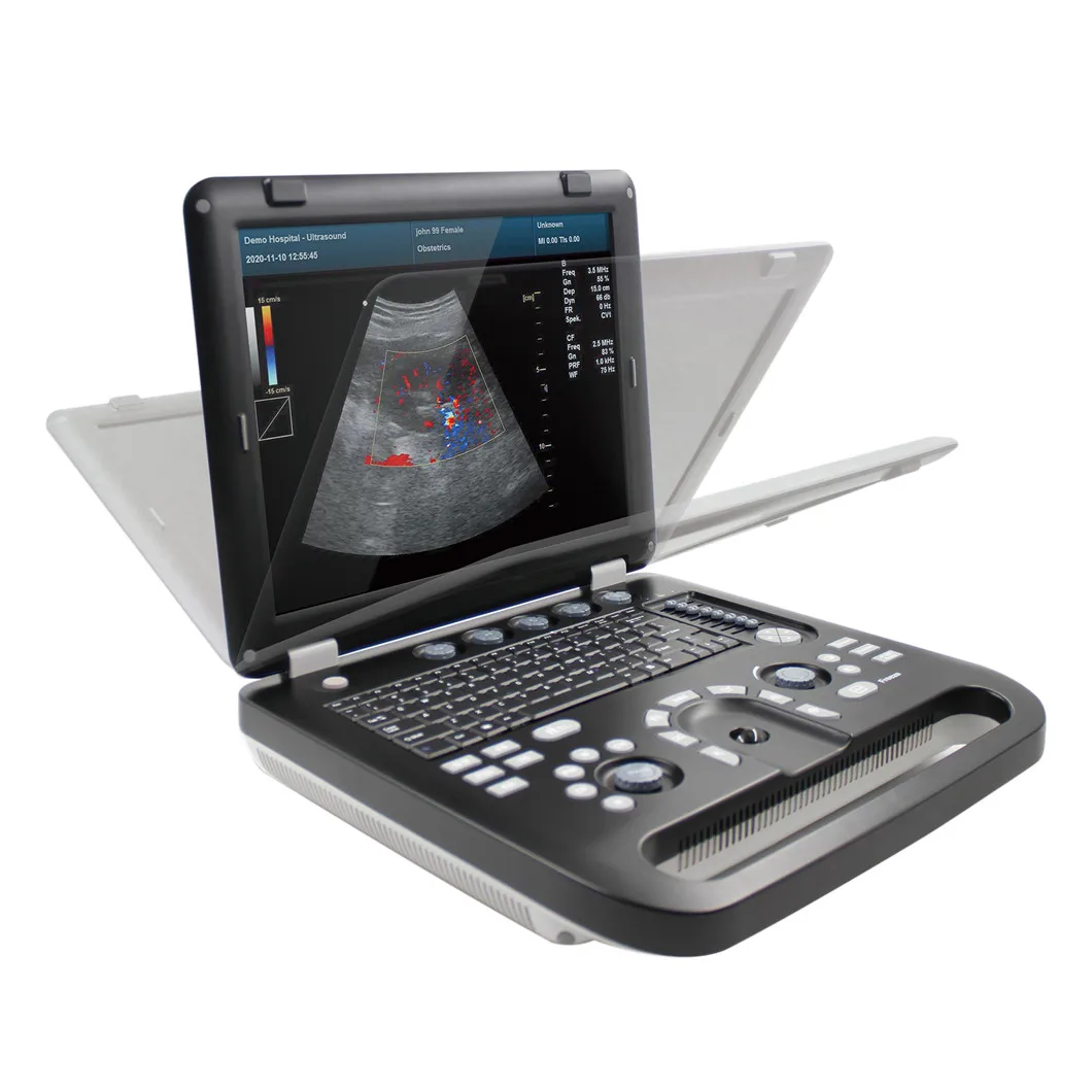 High Quality Ultrasound Scanner 3D 4D 5D Portable Color Doppler Ultrasonic Diagnostic System