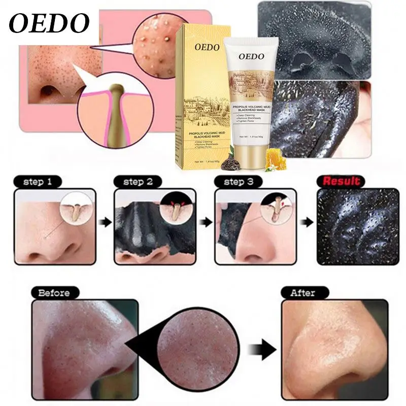 New OEDO Face Care Volcanic Soil Facial  Acne Removal Blackhead Mite Propolis Treatment Facial Cleansing Mud