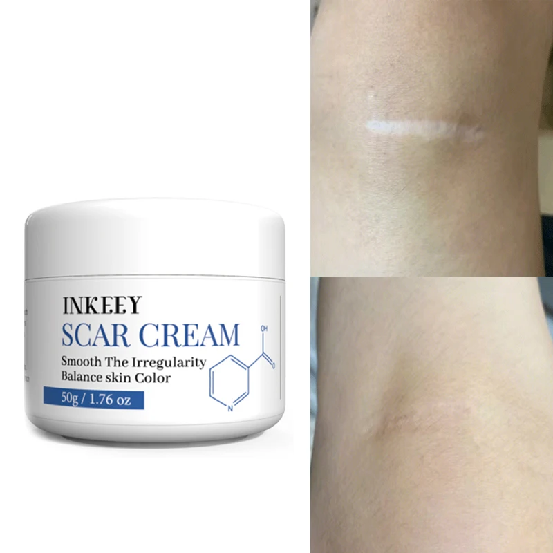 Scar Removal Cream ForSkin Care Scar Removal  Butter  whitening cream