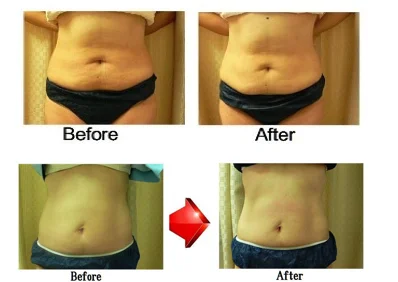 
Home easy use no side effects body fat burn cream stomach slimming 