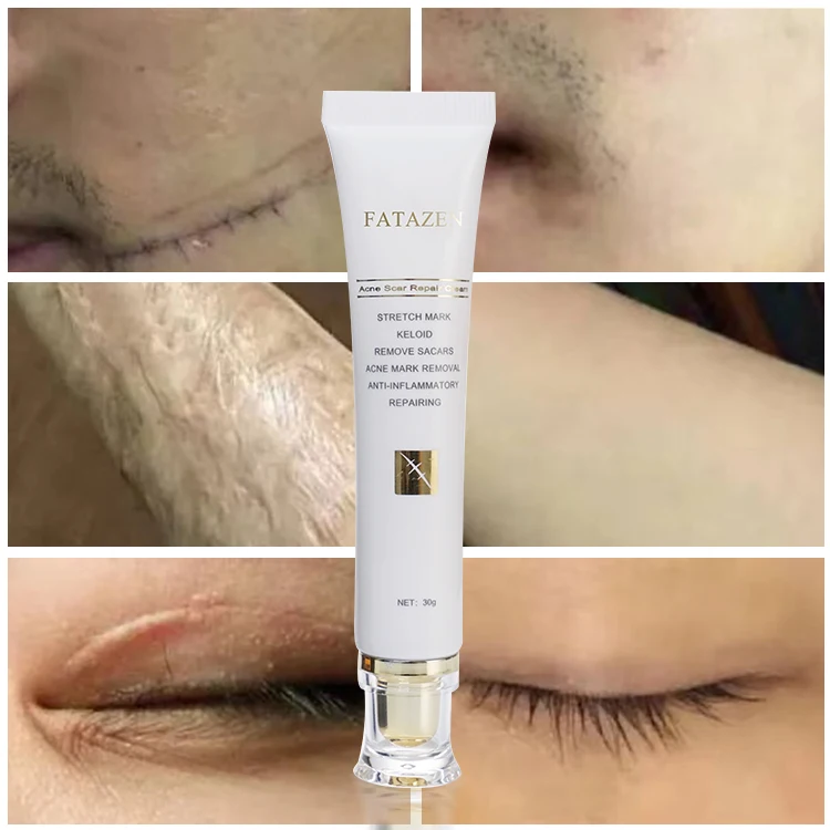 Customize Logo 30g Women Face Body Care Scar Repair Cream Acne Treatment Firming Fast Effective Scar Removal Cream