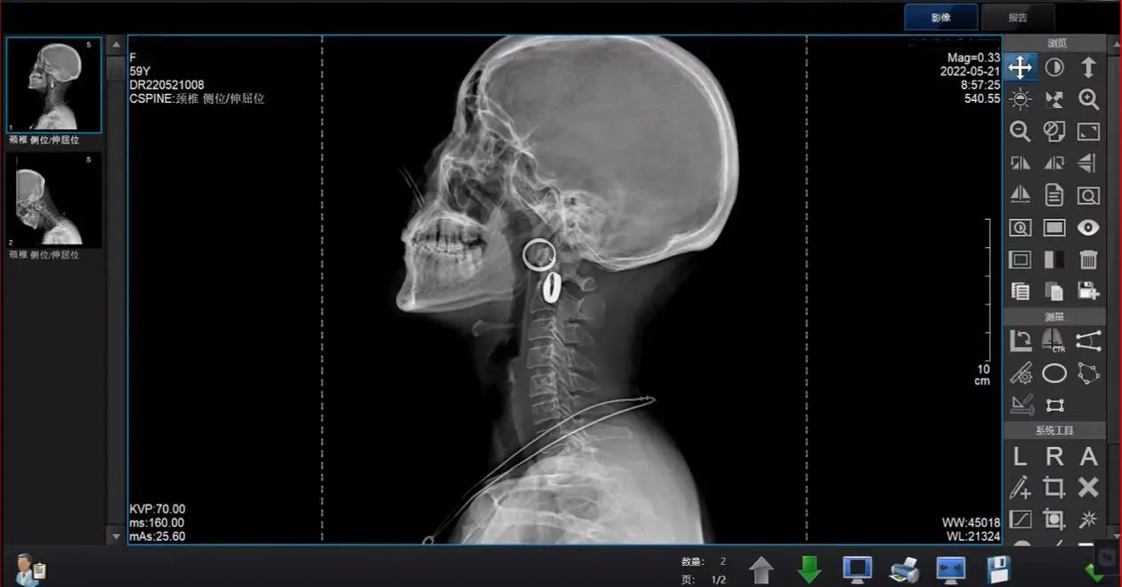 Medical X Ray Flat Panel Detector Veterinary Digital Flat Panel X-ray DR System Cmos Wireless Xray Flat Panel Detector