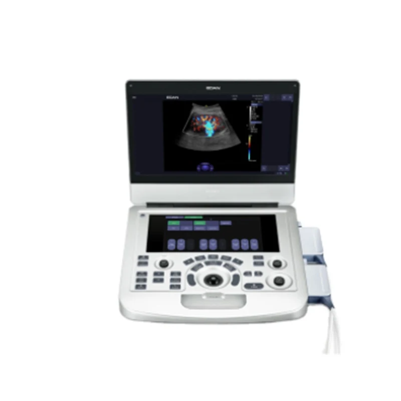 EDAN AX3 Color Doppler Ultrasound 15.6inch Display with 10.1 touch screen 120GB Gynecology,Cardiovascular