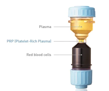 TD4N PRP Centrifuge platelet rich plasma kit centrifuge