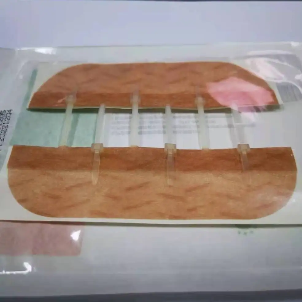 Quick apply surgical incision zip wound skin closure sterile strip skin closure