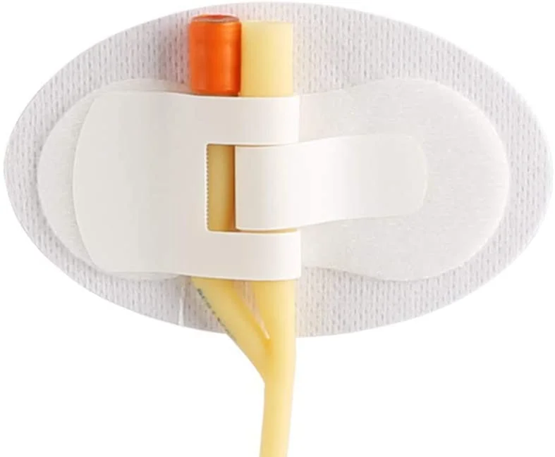
Factory Customization Statlock Foley Catheter Stabilization 
