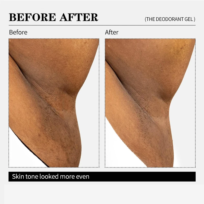 Private label natural aha niacinamide fragrance free whitening underarm armpit body antiperspirant deodorant gel stick