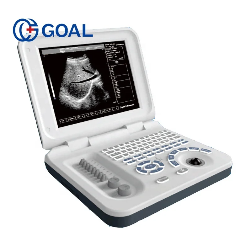 Новый продукт запуск в Китае беременность недели измерения полный цифровой 3d ультразвуковая машина цена