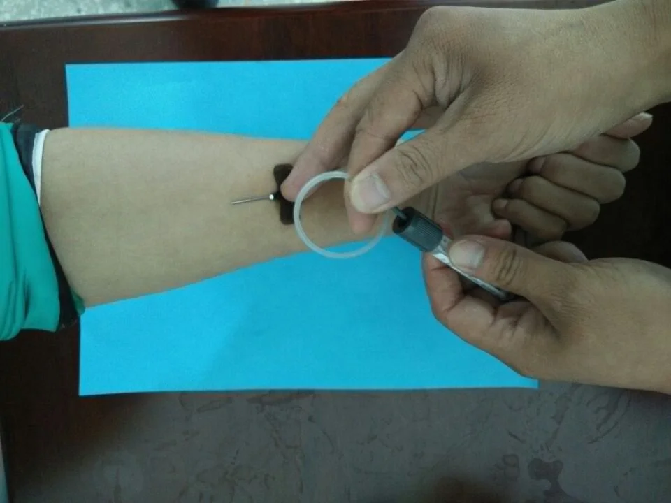 Safety Medical Disposable Scalp Vein Set With Butterfly Wing Hypodermic Needle For Infusion Made In China