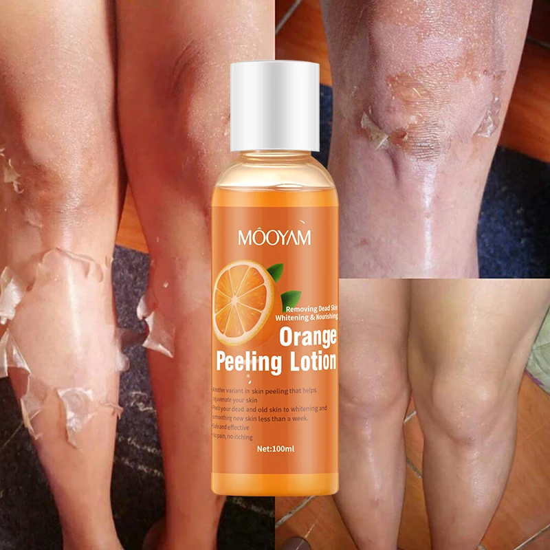 Wholesale organic aha bha skin care peel off lotion black skin whitening orange body peeling lotion
