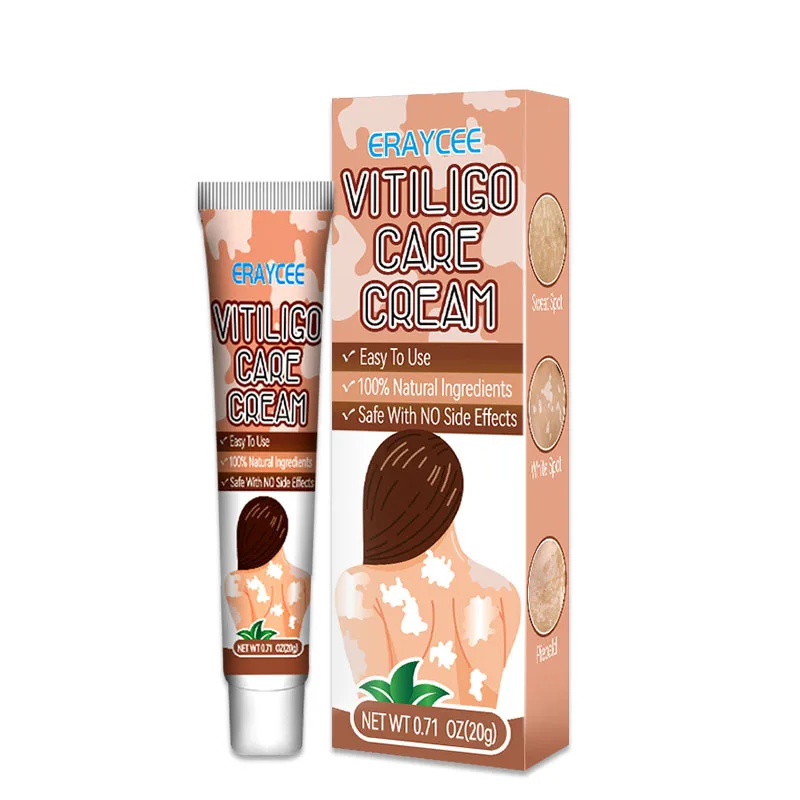 Vitiligo Safe and Effective Treatment Cream White Spot Ointment Flower Spot Sweat Purpura Skin Topical Ointment