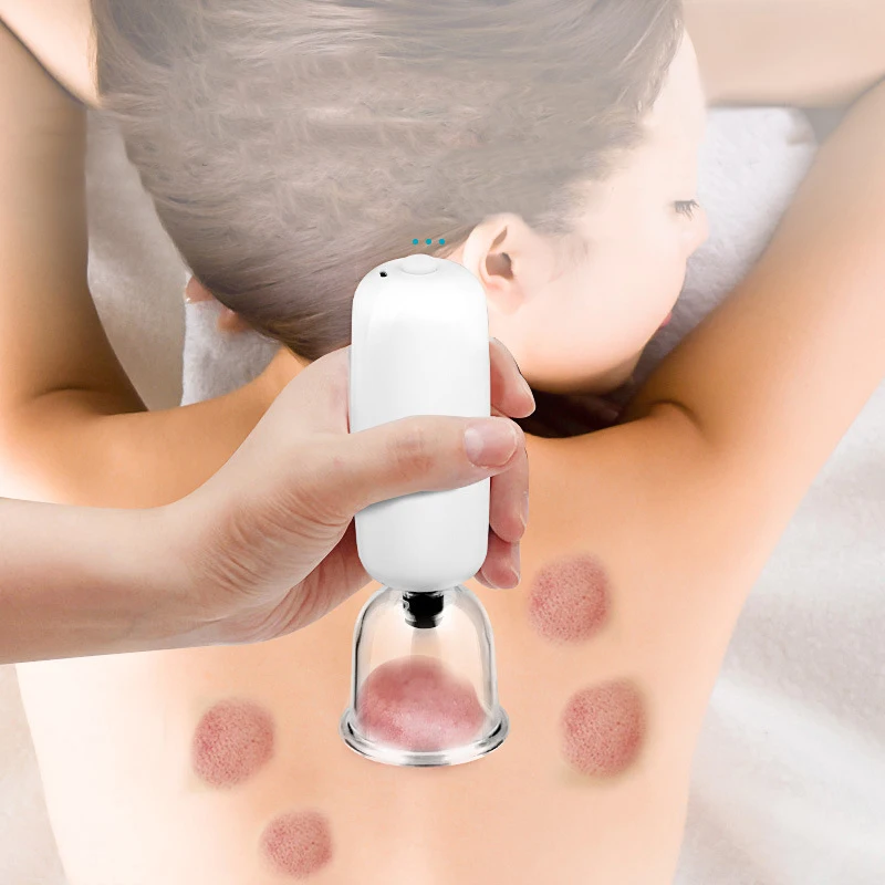 China wholesale high quality vacuum therapy cup cupping acupuncture cupping