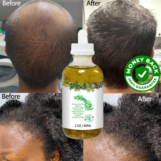 factory wild organic fast serum hair growth oil private label hair growth oil for black women rosemary oil hair growth