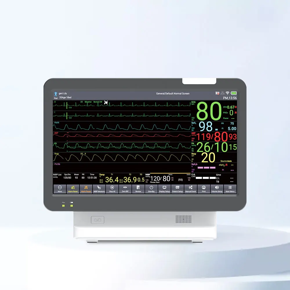 Контекс TS18 монитор пациента ICU ETCO2 ECG подключаемый жизненно важных знаков