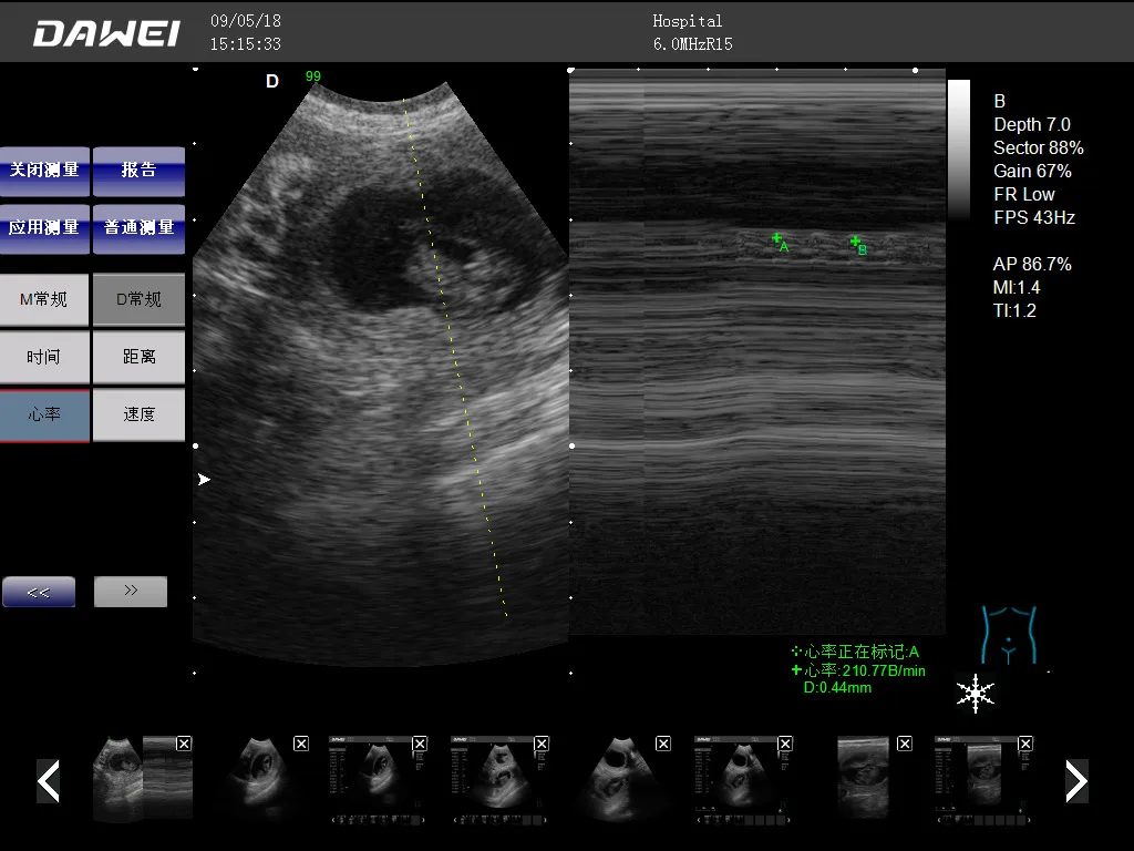 Dawei Portable Ultrasound Machine Small Animal Ultrasound Cost Pet Color Ultrasound Machine