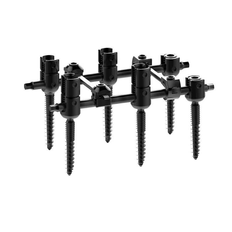 High Quality Spinal Pedicle Screw Fixation System 5.5mm Double Threaded Screws Orthopedic Surgical Spine Implants