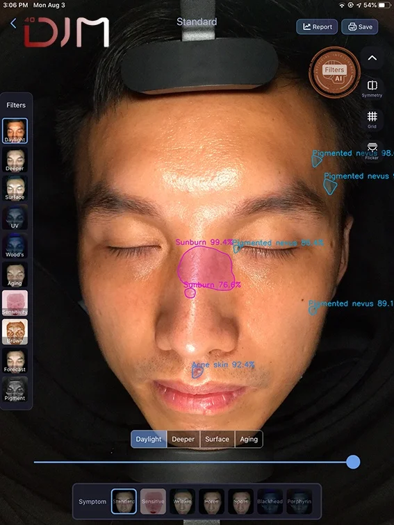 DJM Portable Facial Skin Analyzer Machine Moreme Smart Skin Scan For Face