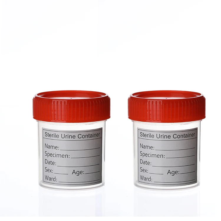 Professional Standardized Leakproof Design Lab Consumables Sterile Urine Container