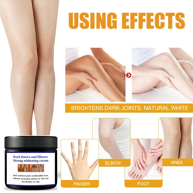 Best Selling Dark Spot Corrector Remover Private Label Skin Care Serum Whitening Freckle Bleaching Cream for Dark Skin