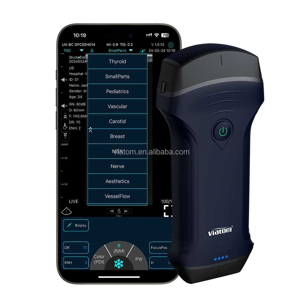 Viatom 2.5/5mhz Portable Ultrasound Machine Portable IP68 Waterproof Design Work Time 3 Hours Medical Handheld Ultrasound Probe