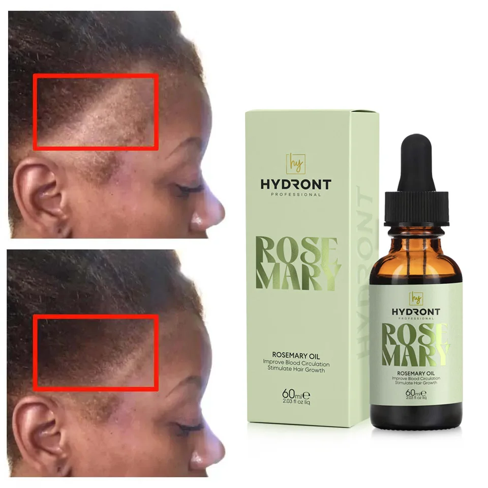 Hot Sale 2024 The Best Hair Growth Oil Natural And Pure Rosemary Oil For Baby And Women  Hair Growth
