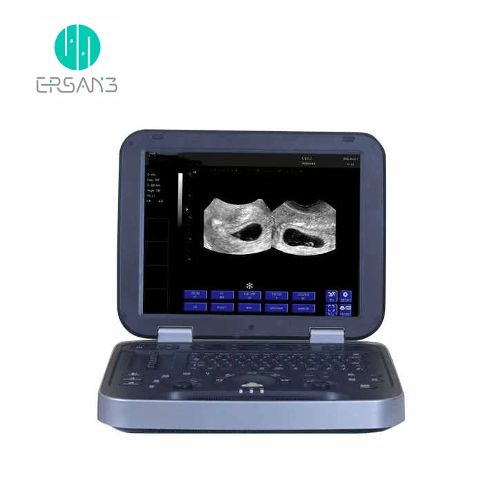 Hot Sale portable animals ultrasound Scanner Machine For cow horse Animal Veterinary Ultrasound with prode
