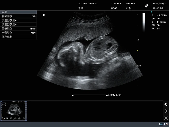 C10B Color Doppler Ultrasound Machine Portable Device