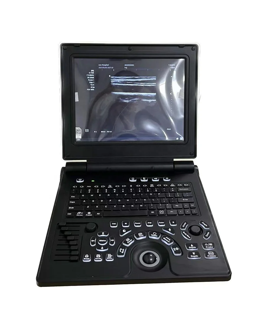 Cheapest Color doppler 3D 4d  obstetric  ultrasound scanner diagnostics scanner for hospitals