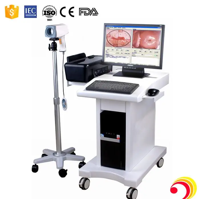 Full HD digital video camera colposcope gynecology video colposcope for vagina