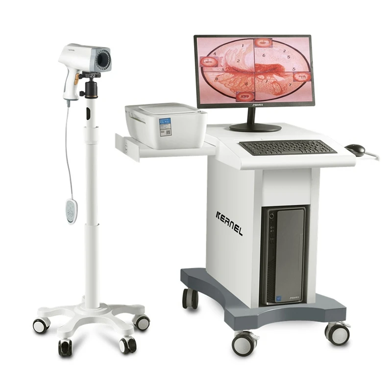 CE Approved KERNEL KN 2200 Portable Digital Video Colposcope for Gynecology Vagina Examination